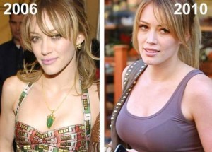 Hilary Duff Plastic Surgery – Too Young For The Knife