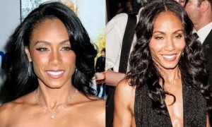 Jada Pinkett Smith Plastic Surgery – Cheek Implants, Facelift & Botox