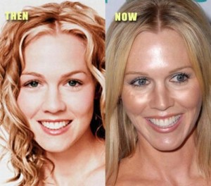 Jennie Garth Plastic Surgery Done Well