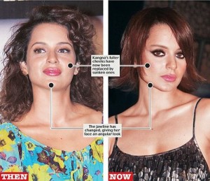 Kangana Ranaut Plastic Surgery Rrumours – Fact or Fiction?