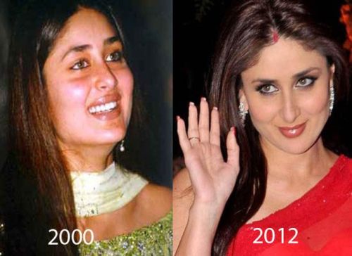 Kareena Kapoor plastic surgery before after