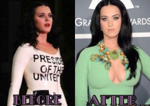 Katy Perry Plastic Surgery is a Hoax