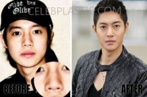 Kim Hyun-Joong Plastic Surgery Before and After Photos