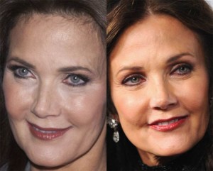Lynda Carter Plastic Surgery on Media and Public Glare
