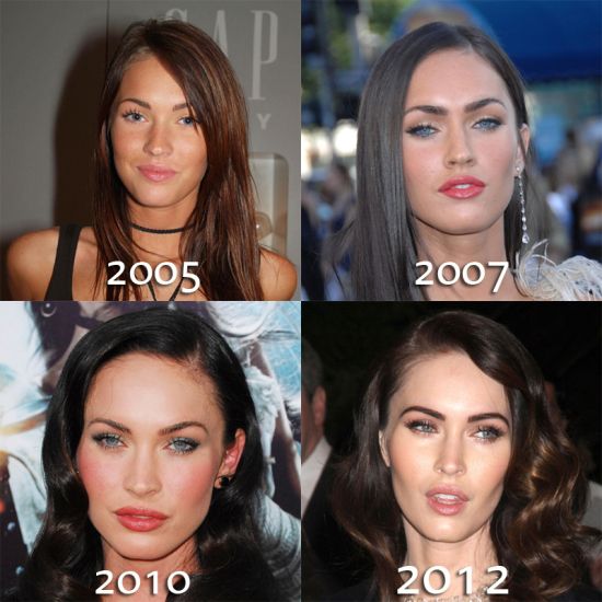 Megan Fox plastic surgery before and after photos