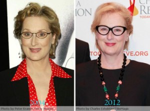 Meryl Streep Plastic Surgery – Done in a Clinical Way