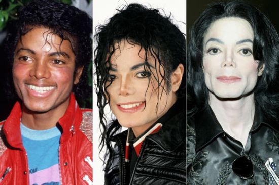 Michael Jackson plastic surgery photos