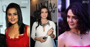 Preity Zinta Plastic Surgery Was a Success