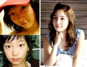 SNSD Plastic Surgery – Carefully Done Successful Procedures