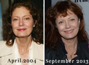 Susan Sarandon Plastic Surgery – Breast Implants, Liposuction & Botox