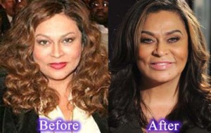 Tina Knowles Plastic Surgery – Intended Look?
