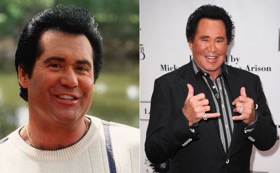 Wayne Newton plastic surgery before and after