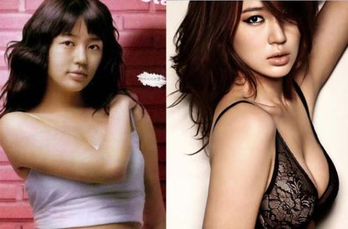 Yoon Eun Hye plastic surgery before and after