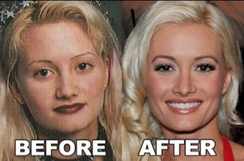 Holly Madison nose job before and after