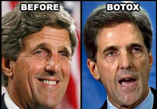 John Kerry plastic surgery