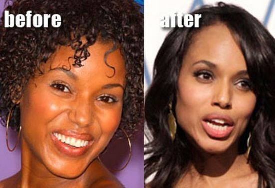 Kerry Washington plastic surgery before and after